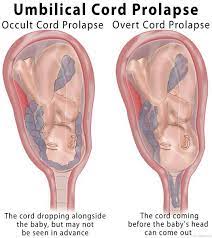 Pin By Heather Demassa On Gynecology Obstetrics Gynecology Midwife