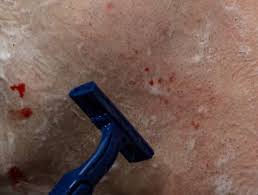 See full list on realmenrealstyle.com 5 Shaving Cut Fixes Products That Stop Bleeding Fast Bald Beards