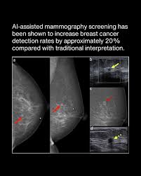 Image result for Mammogram Interpretation
