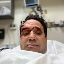 WATCH: Owner of Stein's Deli pistol-whipped, carjacked in front of store