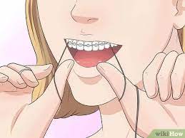 Maybe you would like to learn more about one of these? How To Make Your Braces Hurt Less With Pictures Wikihow