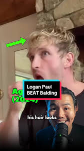 Logan paul beat hair loss. #loganpaul #malepatternbaldness  #hairlosssolutions #balding #baldingmen #hairlossmen #hairlossmen