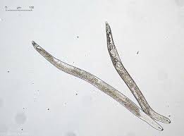 Potato - Ditylenchus spp. and other migratory nematodes