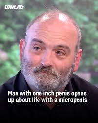 He's been through one hell of a journey 😮