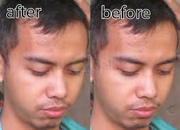 Snow tomato untuk cara menghilangkan jerawat dan bekas jerawat. Cara Menghilangkan Jerawat Dan Komedo Dengan Photoshop Video Tutorial89