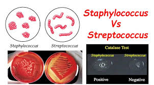 Image result for Streptococcus