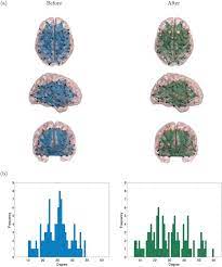Shannon Entropy Of Brain Functional Complex Networks Under The Influence Of The Psychedelic Ayahuasca Scientific Reports