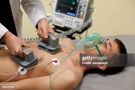 Image result for Defibrillation Equipment