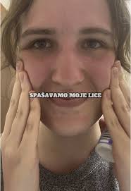 Kako sam izgorila na suncu i lekovi za opekotine