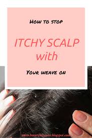 Why Does My Scalp Itch And How Do I Stop It Dry Itchy Scalp Itchy Scalp What Causes Itchy Scalp
