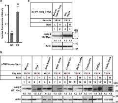 We did not find results for: Competitive Oxidation And Ubiquitylation On The Evolutionarily Conserved Cysteine Confer Tissue Specific Stabilization Of Insig 2 Nature Communications