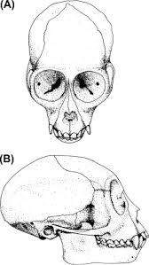The Skull (Chapter 4) - Skeletal Anatomy Of The Newborn Primate