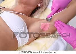 I discovered the hard way that if you just hold your arm. Waxing Armpit Hair Stock Image K37495550 Fotosearch