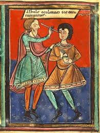 Opa C Ration De Cataracte Au Xive Sia Cle Enluminure Moyen Age Histoire Medievale Art Roman