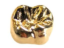 Reprise de toutes les cotations. 18 Carats Tout Savoir Sur Le Titrage De L Or 18 Carats Composition Prix Poincons Utilisation Orobel