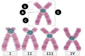 Robertsonian translocation is a rare rearrangement which commonly occurs in acrocentric chromosomes. Robertsonian Translocation Wikipedia