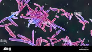 Image result for Erysipeloid