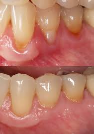 View david semeniuk's genealogy family tree on geni, with over 200 million profiles of ancestors and living relatives. For Dentists