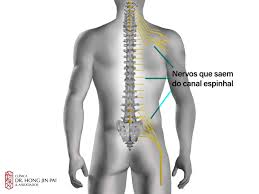 Artrose na coluna - Clínica Dr. Hong Jin Pai - Dor, Fisiatria e Acupuntura  Médica
