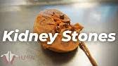 Horses function at their best if the stomach isn't filled with more than 2 gallons. How Much Food Can The Human Stomach Hold Youtube