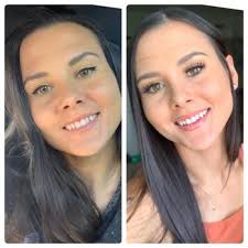 COSMETIC SURGERY & LASER CENTERS OF EL PASO