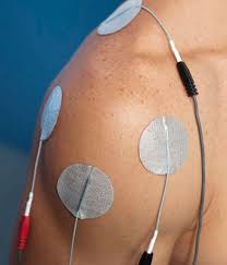 Image result for Electrical Stimulation Therapy
