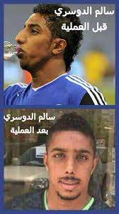 في 21 يناير 2018 أعلن نادي فياريال عن ضم سالم الدوسري على سبيل الإعارة من نادي الهلال السعودي لمدة 6 أشهر. Ø£Ø­ Ù€Ù€Ù€Ù€Ù…Ø¯ Twitterren Ø³Ø§Ù„Ù… Ø§Ù„Ø¯ÙˆØ³Ø±ÙŠ Ù‚Ø¨Ù„ ÙˆØ¨Ø¹Ø¯ Ø§ÙˆÙ„ Ù†Ù‚ÙˆÙ„ Ù„Ù„Ø­Ø±ÙŠÙ… Ù‡Ø°ÙŠ Ù…Ø³ÙˆÙŠÙ‡ Ø¹Ù…Ù„ÙŠØ© ØªØ¬Ù…ÙŠÙ„ Ø§Ù„Ø­ÙŠÙ† Ù†Ø³Ø£Ù„ Ù‡Ø§Ù„Ø§Ø¹Ø¨ Ù…Ø³ÙˆÙŠ Ø¹Ù…Ù„ÙŠÙ‡ Ø§Ù„ØªØ¬Ù…ÙŠÙ„ ÙˆÙ„Ø§Ù„Ø§ Http T Co 4swdfnpcpk