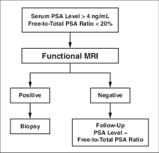 prostate cancer is the second most common cancer diagnosed in men in australia and the third most common cause of cancer death. Algorithm For Early Detection Of Prostate Cancer Based On Morphologic Download Scientific Diagram