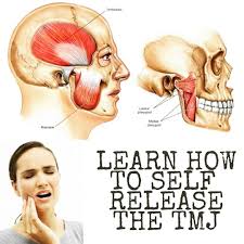 Pin On Tmj Go Away