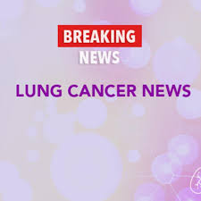 If someone has lung cancer, it is not uncommon to see swelling on the neck and face once the cancer spreads to the lymph nodes. 5 Things Women Should Know About Lung Cancer Cancerconnect