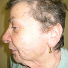 Full view of the patient's face.