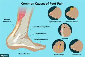 There are also more intriguing shapes such as curved, spherical, concave and rectangular. Foot Anatomy Physiology And Common Conditions