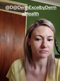 Mi primera experiencia con Dermexcel