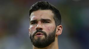  Alison Becker Tweets I M Joining Liverpool But All Is Not As It Seems As Com