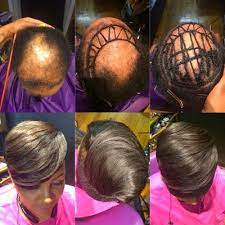 Queen Of The Naija Blog Thick Hair Remedies Alopecia Hairstyles Black Women Hair Loss