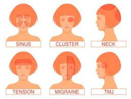 Woke Up With A Headache Today Not Sure If It S Repost Coolguides