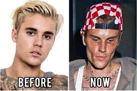 🥺Justin Bieber admits that he tested positive for…See More