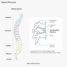 Invest the time to create documentation like network diagrams, an ip address list, and equipment inventory. Broken Back Symptoms Treatment And Recovery