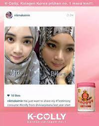 I will show you which collagen supplement works best? Qoo10 K Colly Sweet 17 Dietary Management