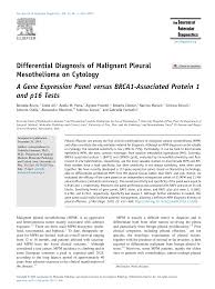 Mesothelioma is a rare cancer caused by asbestos. Https Www Jmdjournal Org Article S1525 1578 20 30019 2 Pdf