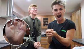 Check spelling or type a new query. What Is The Salt And Ice Challenge The Craze Causing Burns In Children Sweeping The Web Express Co Uk