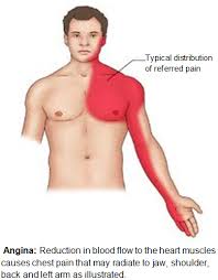 Pin On Nursing