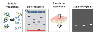 Maybe you would like to learn more about one of these? Western Blot Antibody Troubleshooting