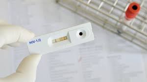 Allerdings rechnet der arzt beim testen auf hiv das blutbild als individuelle gesundheitsleistung ab, der patient muss selbst dafür bezahlen. Hiv Test Onmeda De