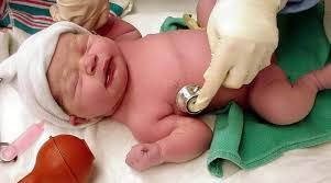 We did not find results for: Sistem Skor Apgar Dan Tanda Tanda Vital Bayi Baru Lahir Gustinerz Com