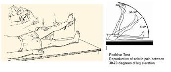 Image result for Low Back Exam