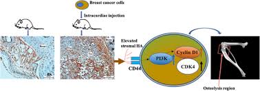 In myeloma, the cells grow too much, crowding out normal cells in the bone marrow that make red blood cells, platelets, and other white blood cells. Remodelling Of The Bone Marrow Microenvironment By Stromal Hyaluronan Modulates The Malignancy Of Breast Cancer Cells Cell Communication And Signaling Full Text