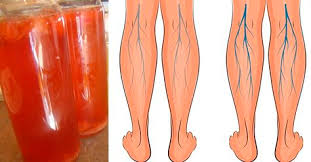 6 типов ожирения и как справиться с каждым из них Pin On Zdorove