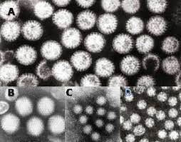 Learn treatment options for gastroenteritis, including home remedies. Gastroenteritis Wikipedia