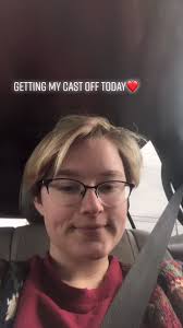 Hairy Leg After Cast